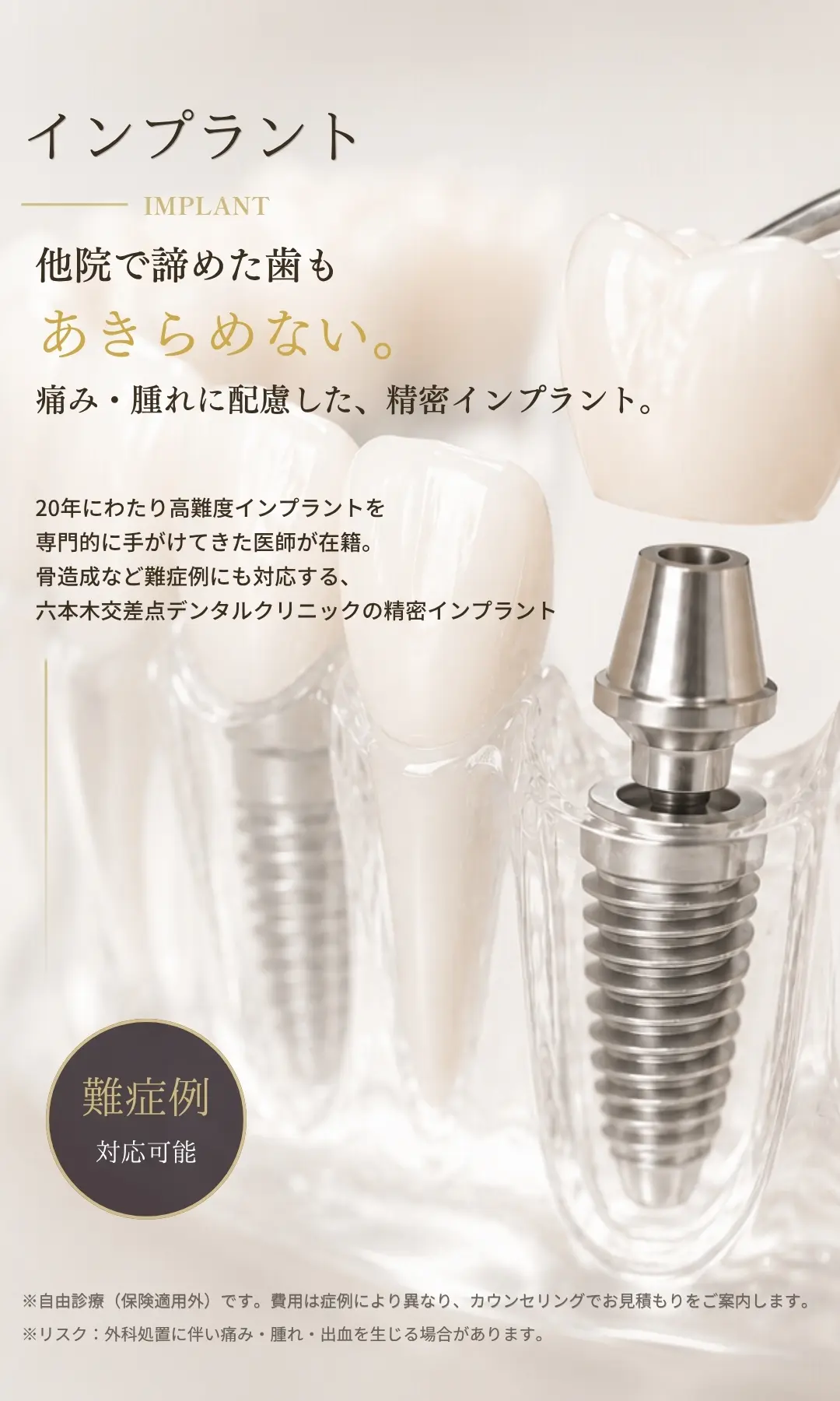 六本木交差点デンタルクリニックの精密インプラント治療